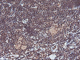 MGLL Antibody in Immunohistochemistry (Paraffin) (IHC (P))