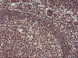 MGLL Antibody in Immunohistochemistry (Paraffin) (IHC (P))