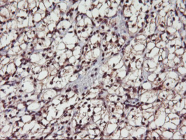 MGLL Antibody in Immunohistochemistry (Paraffin) (IHC (P))