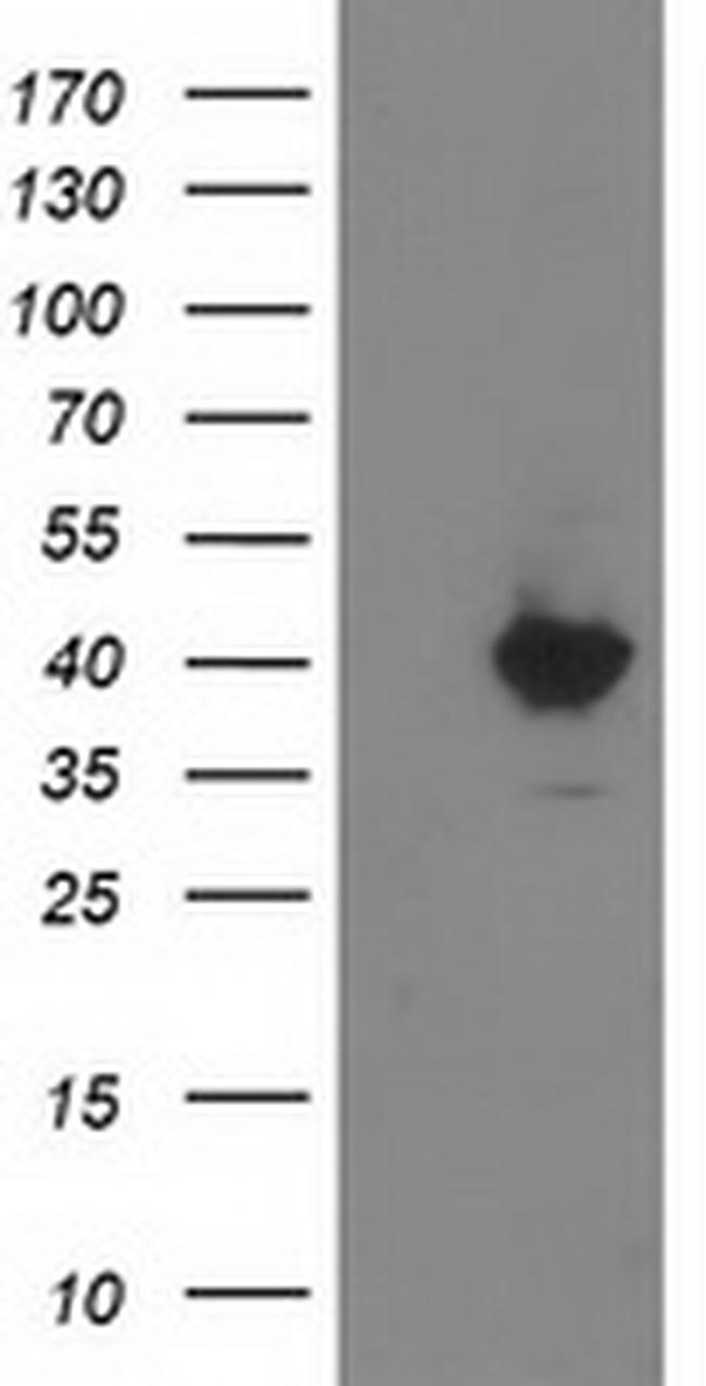 MGLL Antibody in Western Blot (WB)