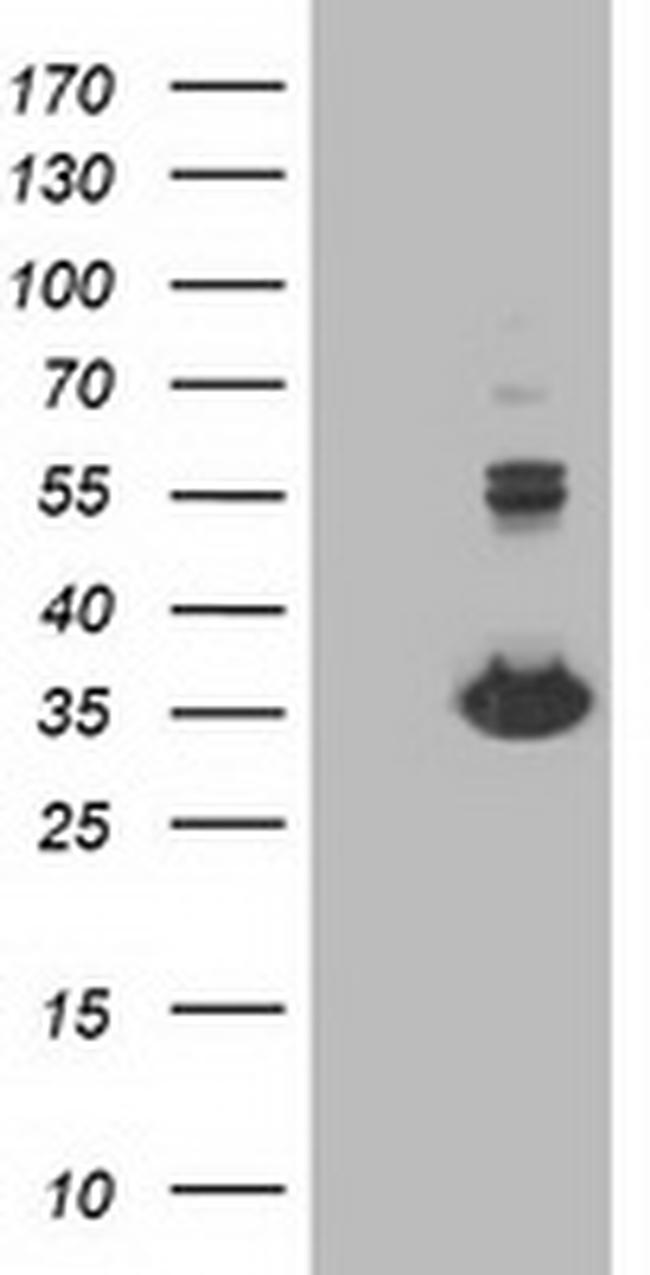 MGLL Antibody in Western Blot (WB)