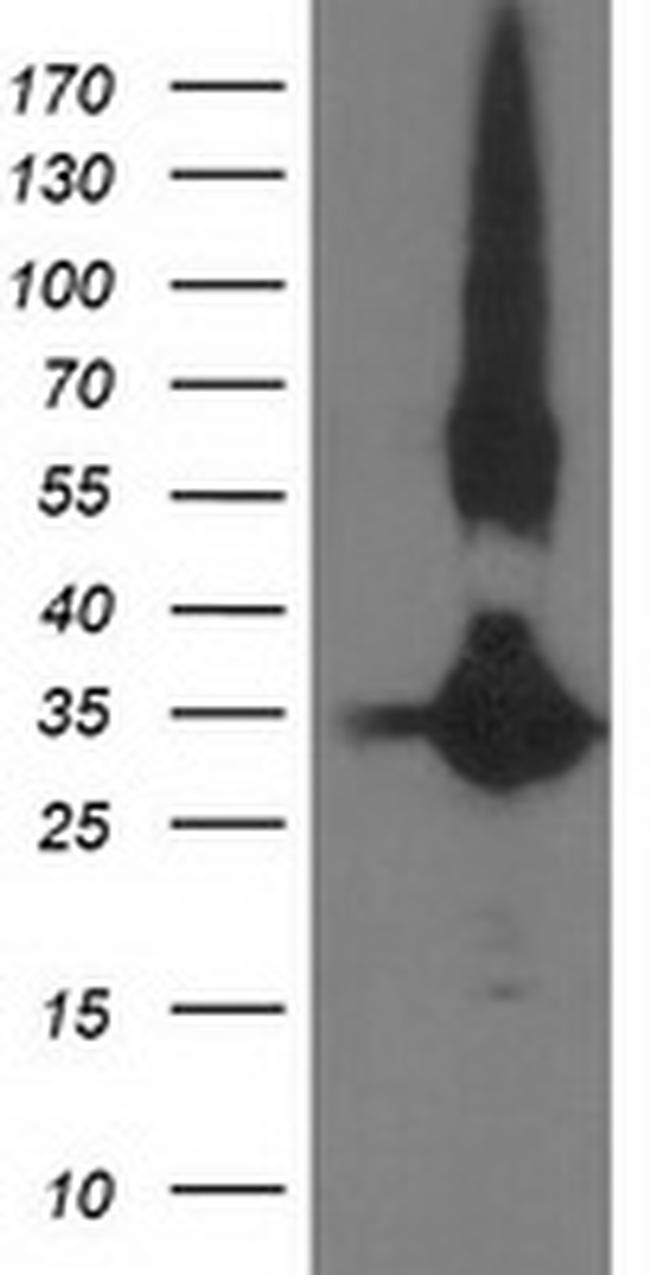 MGLL Antibody in Western Blot (WB)