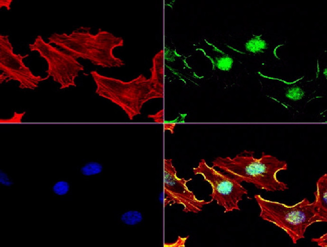 MGMT Antibody in Immunocytochemistry (ICC/IF)