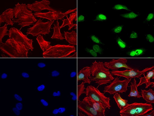 MGMT Antibody in Immunocytochemistry (ICC/IF)