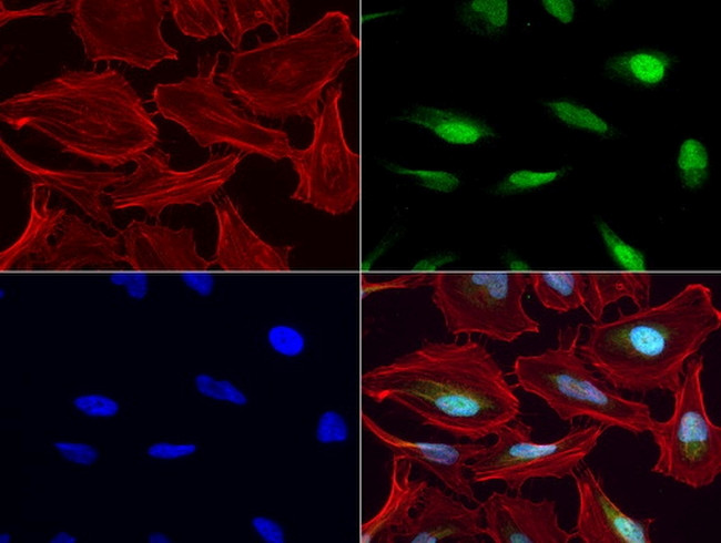 MGMT Antibody in Immunocytochemistry (ICC/IF)