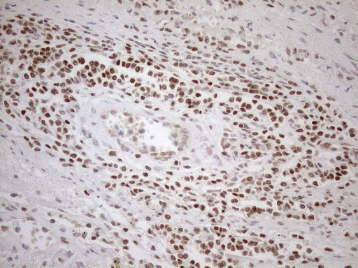 MGMT Antibody in Immunohistochemistry (Paraffin) (IHC (P))