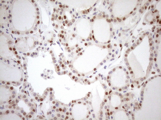 MGMT Antibody in Immunohistochemistry (Paraffin) (IHC (P))