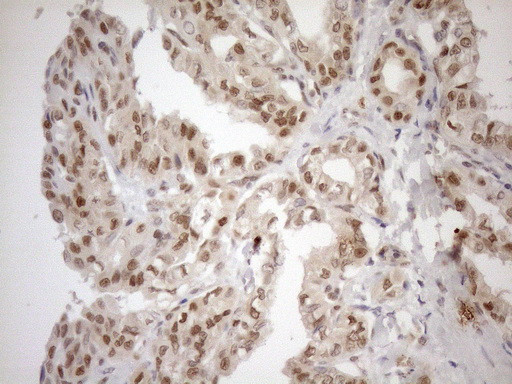 MGMT Antibody in Immunohistochemistry (Paraffin) (IHC (P))