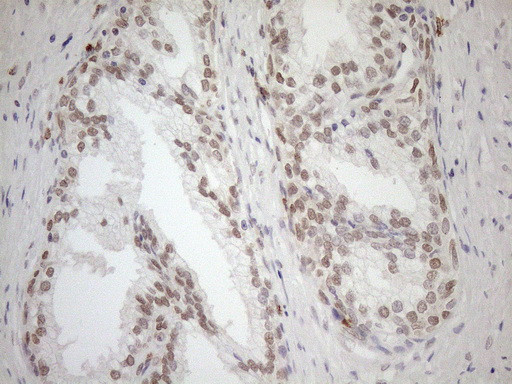 MGMT Antibody in Immunohistochemistry (Paraffin) (IHC (P))