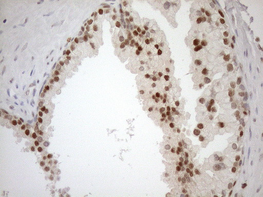 MGMT Antibody in Immunohistochemistry (Paraffin) (IHC (P))