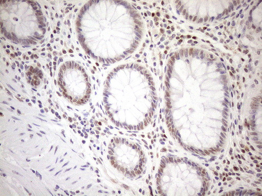 MGMT Antibody in Immunohistochemistry (Paraffin) (IHC (P))