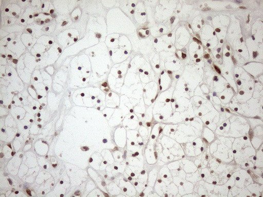 MGMT Antibody in Immunohistochemistry (Paraffin) (IHC (P))