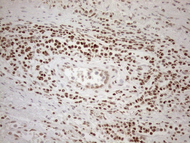 MGMT Antibody in Immunohistochemistry (Paraffin) (IHC (P))