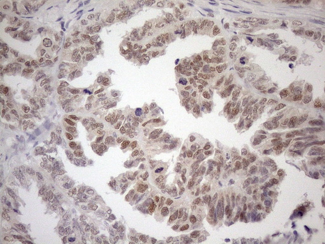 MGMT Antibody in Immunohistochemistry (Paraffin) (IHC (P))