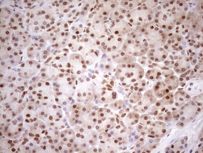 MGMT Antibody in Immunohistochemistry (Paraffin) (IHC (P))