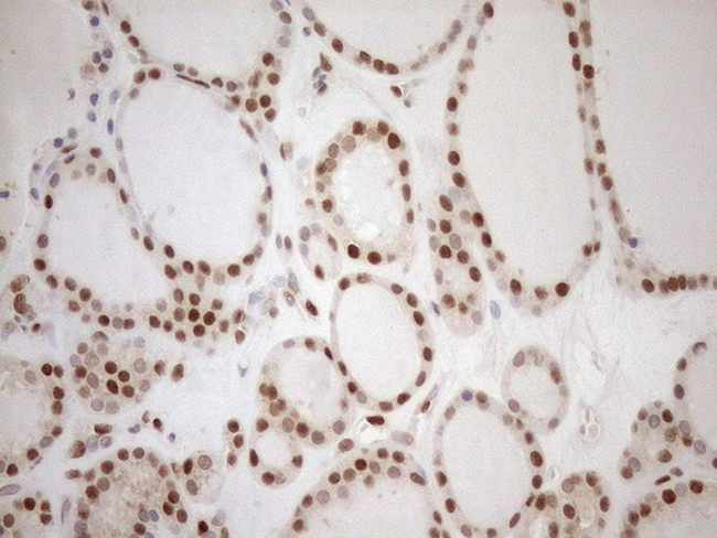 MGMT Antibody in Immunohistochemistry (Paraffin) (IHC (P))