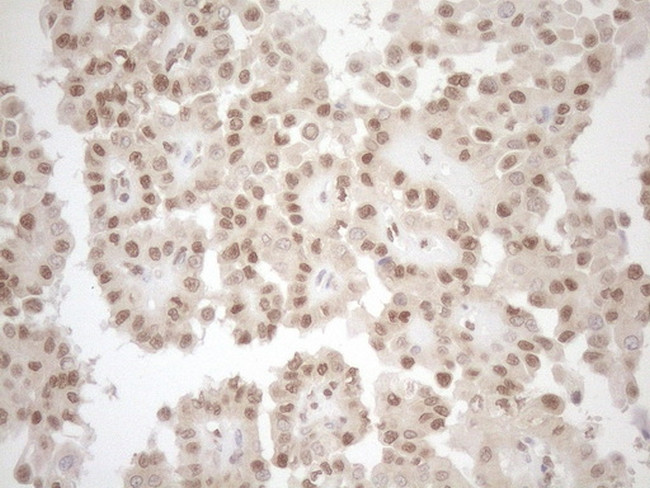 MGMT Antibody in Immunohistochemistry (Paraffin) (IHC (P))