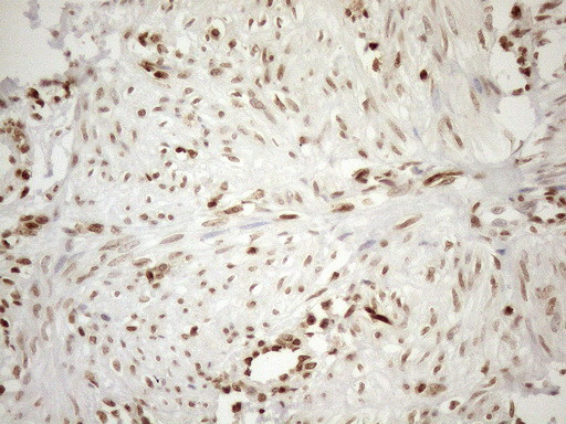 MGMT Antibody in Immunohistochemistry (Paraffin) (IHC (P))