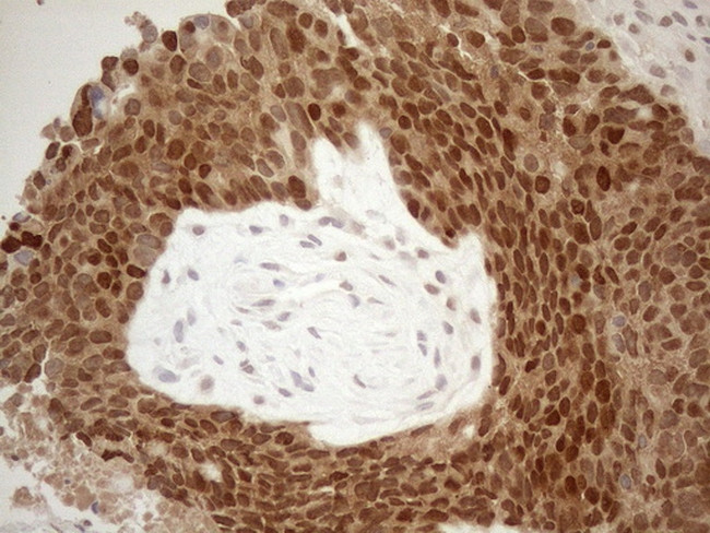 MGMT Antibody in Immunohistochemistry (Paraffin) (IHC (P))