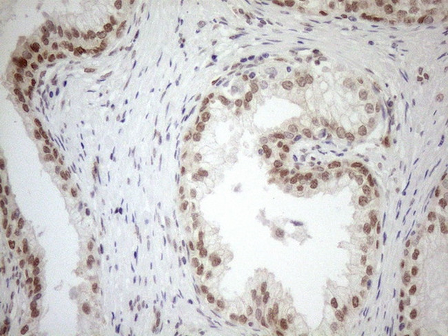 MGMT Antibody in Immunohistochemistry (Paraffin) (IHC (P))