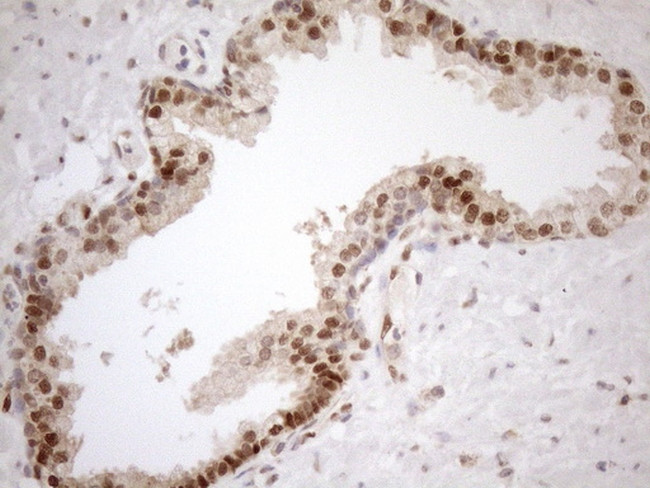 MGMT Antibody in Immunohistochemistry (Paraffin) (IHC (P))