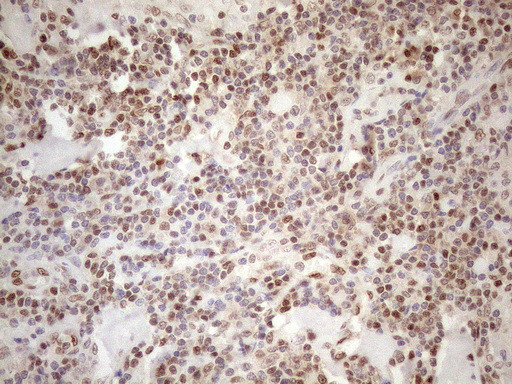 MGMT Antibody in Immunohistochemistry (Paraffin) (IHC (P))