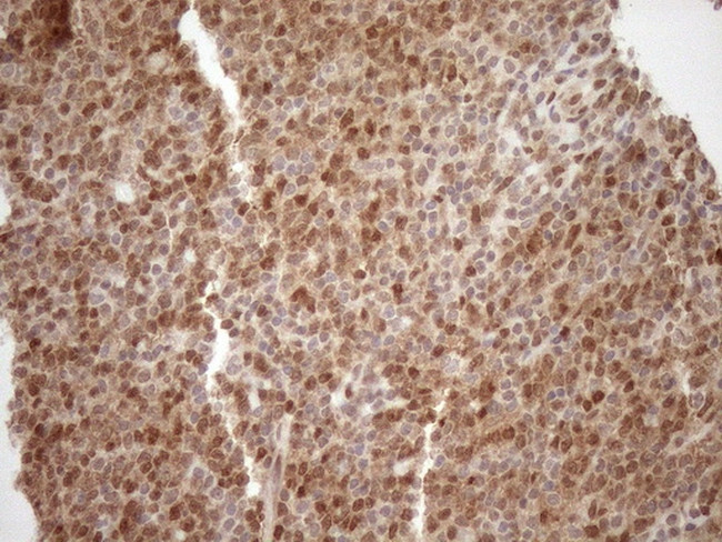 MGMT Antibody in Immunohistochemistry (Paraffin) (IHC (P))