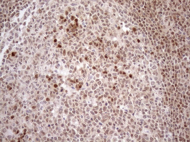 MGMT Antibody in Immunohistochemistry (Paraffin) (IHC (P))