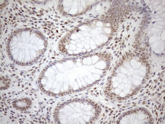 MGMT Antibody in Immunohistochemistry (Paraffin) (IHC (P))