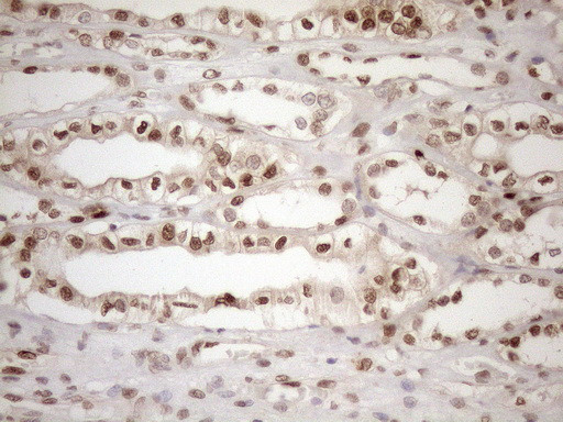 MGMT Antibody in Immunohistochemistry (Paraffin) (IHC (P))