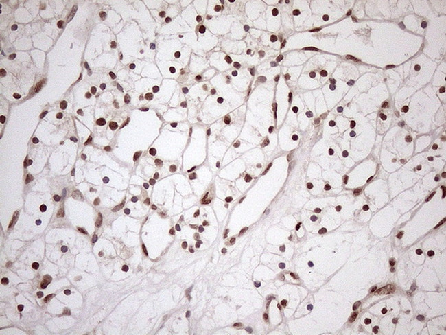 MGMT Antibody in Immunohistochemistry (Paraffin) (IHC (P))