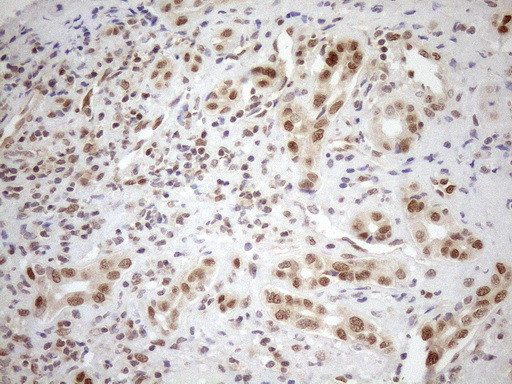 MGMT Antibody in Immunohistochemistry (Paraffin) (IHC (P))