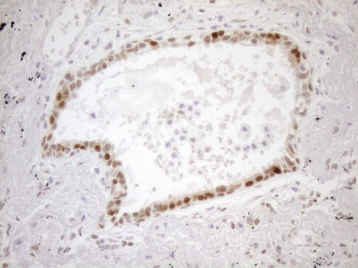 MGMT Antibody in Immunohistochemistry (Paraffin) (IHC (P))