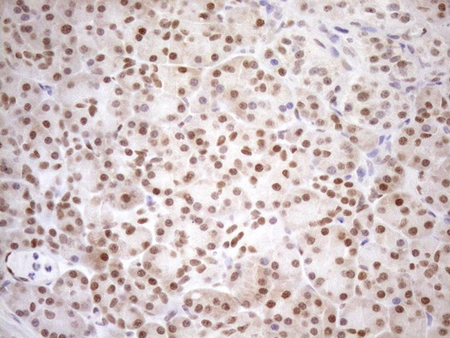 MGMT Antibody in Immunohistochemistry (Paraffin) (IHC (P))
