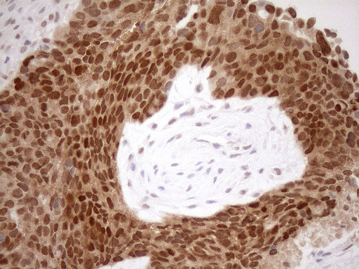 MGMT Antibody in Immunohistochemistry (Paraffin) (IHC (P))