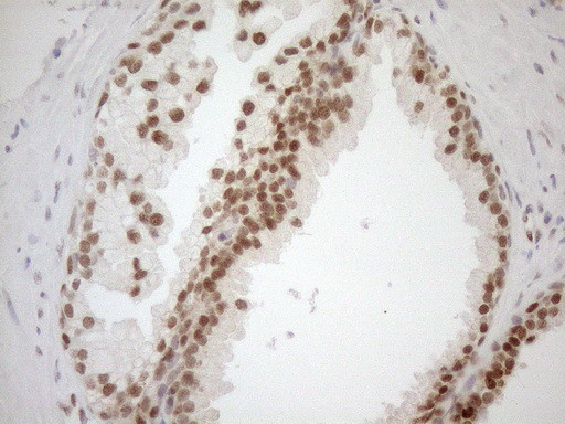 MGMT Antibody in Immunohistochemistry (Paraffin) (IHC (P))