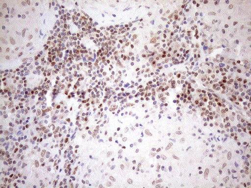 MGMT Antibody in Immunohistochemistry (Paraffin) (IHC (P))