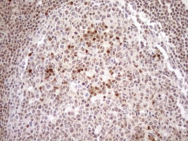 MGMT Antibody in Immunohistochemistry (Paraffin) (IHC (P))