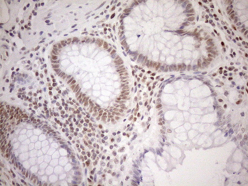 MGMT Antibody in Immunohistochemistry (Paraffin) (IHC (P))