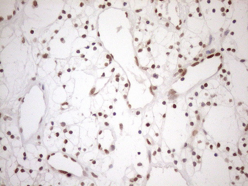 MGMT Antibody in Immunohistochemistry (Paraffin) (IHC (P))