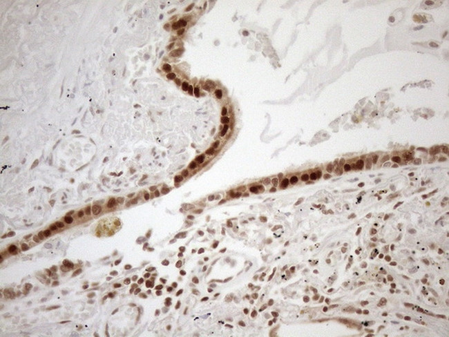 MGMT Antibody in Immunohistochemistry (Paraffin) (IHC (P))