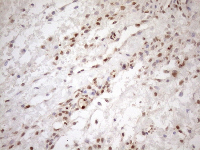 MGMT Antibody in Immunohistochemistry (Paraffin) (IHC (P))