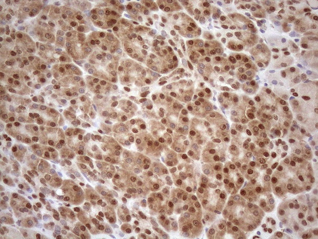 MGMT Antibody in Immunohistochemistry (Paraffin) (IHC (P))