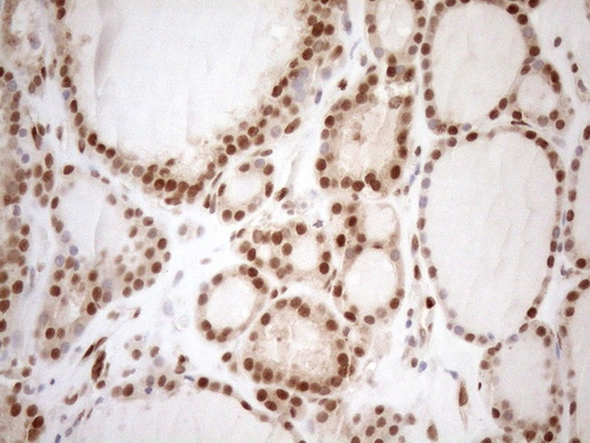 MGMT Antibody in Immunohistochemistry (Paraffin) (IHC (P))