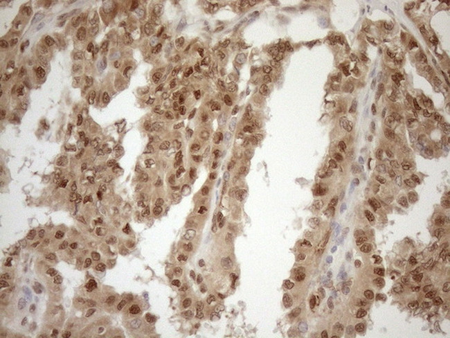 MGMT Antibody in Immunohistochemistry (Paraffin) (IHC (P))