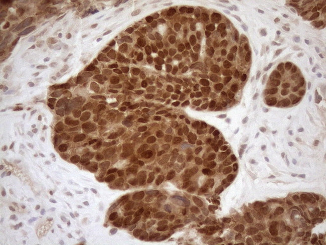 MGMT Antibody in Immunohistochemistry (Paraffin) (IHC (P))