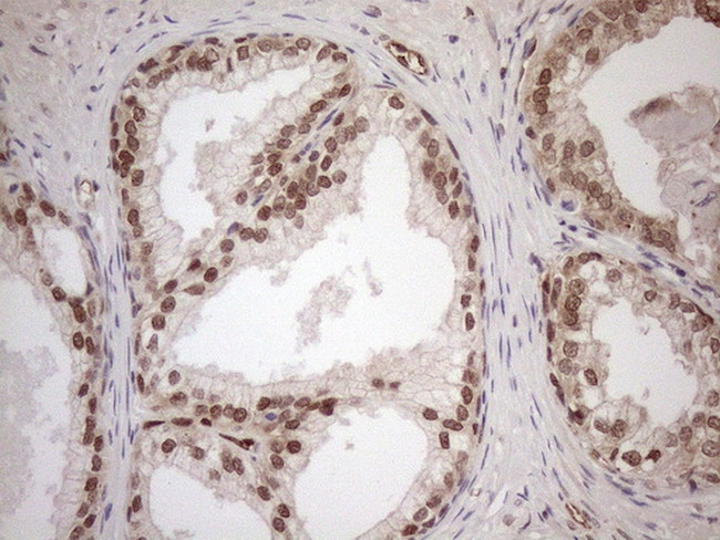 MGMT Antibody in Immunohistochemistry (Paraffin) (IHC (P))