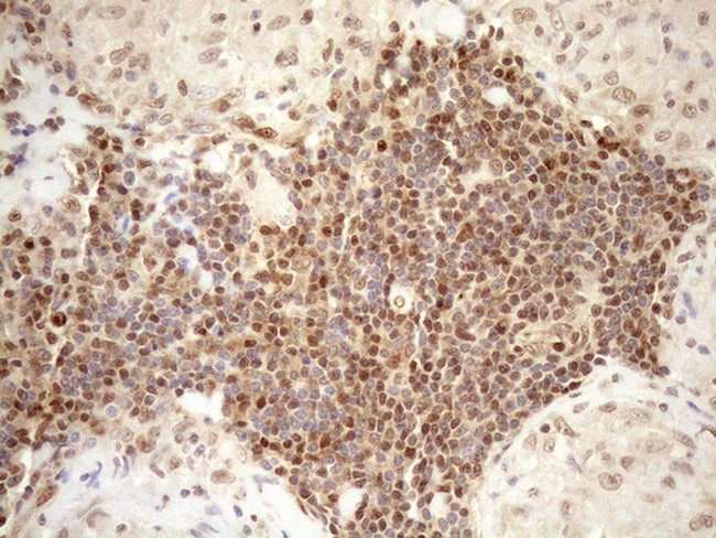 MGMT Antibody in Immunohistochemistry (Paraffin) (IHC (P))