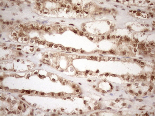 MGMT Antibody in Immunohistochemistry (Paraffin) (IHC (P))