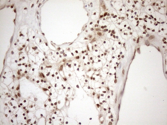 MGMT Antibody in Immunohistochemistry (Paraffin) (IHC (P))